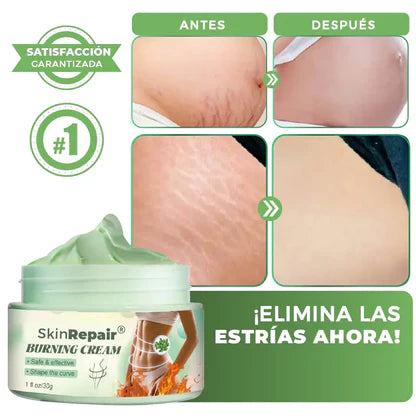 🎁 2x1 HOY | SkinRepair™ Crema Corporal con Envío Gratis y Pago Contra Entrega